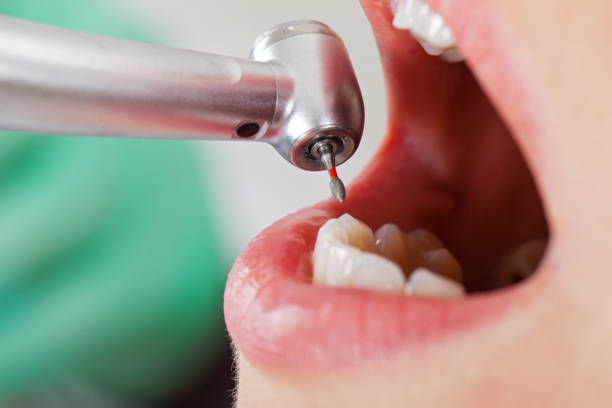 Best Emergency Root Canal Therapy in Mount Union, PA